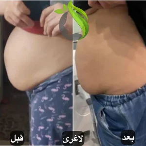 لاغری با دستگاه اگزیمیا