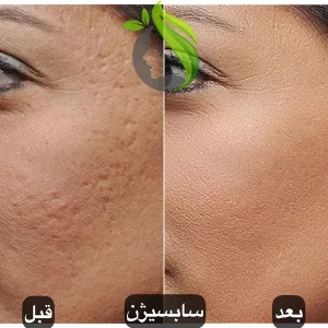 سابسیژن
